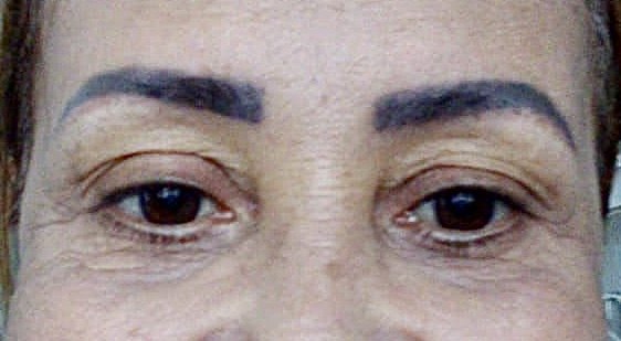 Fotografía 2 del artículo «Tatuaje de cejas “azul”»