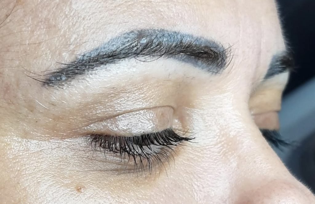 Fotografía 3 del artículo «Tatuaje de cejas “azul”»
