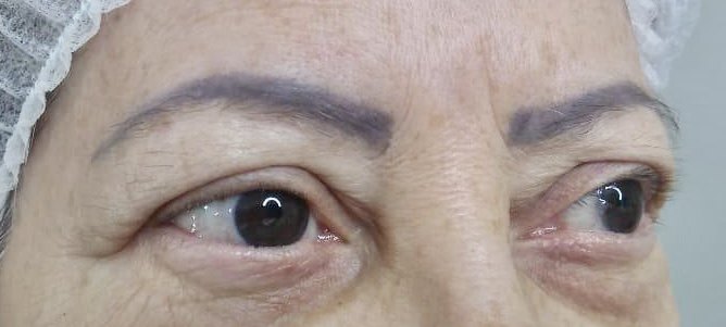 Imagen de la publicación «Tatuaje de cejas “azul”», del archivo de Bar de Cejas
