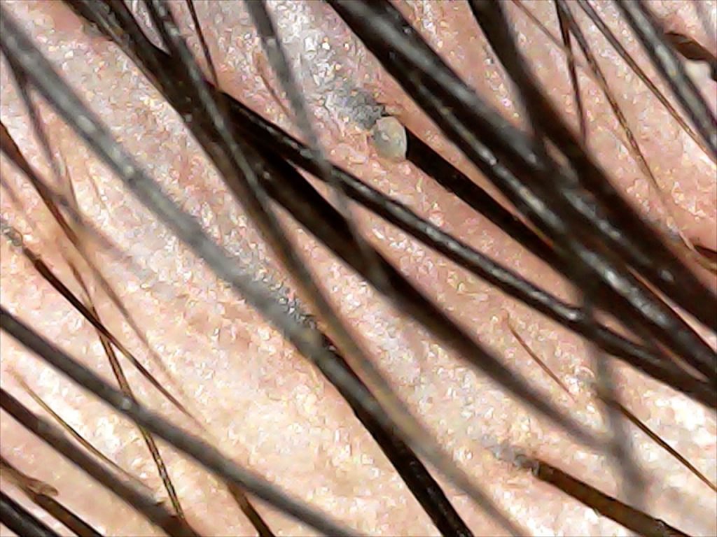 Fotografía 3 del artículo «¡Terapia de Cejas!»