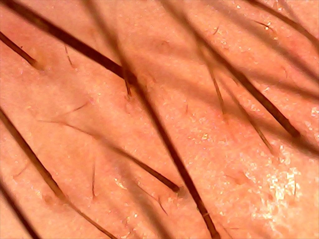 Fotografía 4 del artículo «¡Terapia de Cejas!»